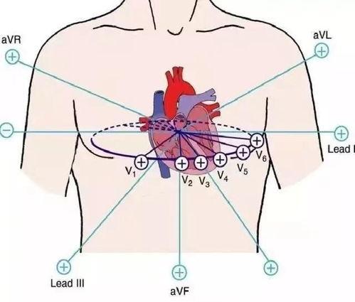 心电图导联位置视频,视频教学与概述